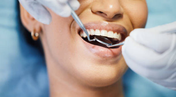 Best Walk-In Emergency Dental Services in Mill Valley, CA