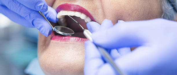 Best Emergency Root Canal Therapy in Mill Valley, CA